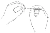 Trimix injection Step 3: Remove needle cover without touching tip — sterile penile injection technique for ED
